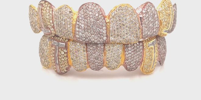 18K Gold Grillz